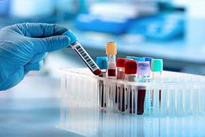 CMLT Lab Technology