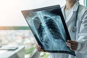 X-Ray Technology
